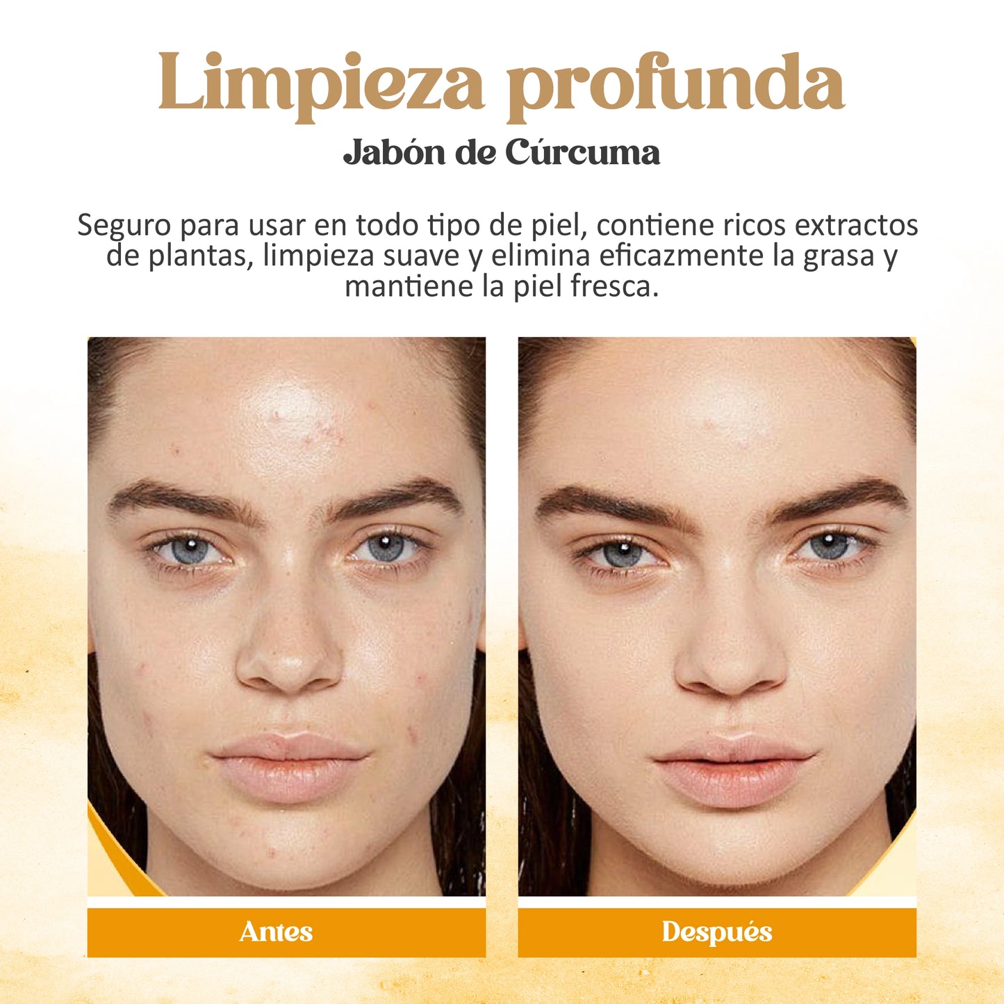 Jabón de cúrcuma y Caléndula | tratamiento contra manchas y acné