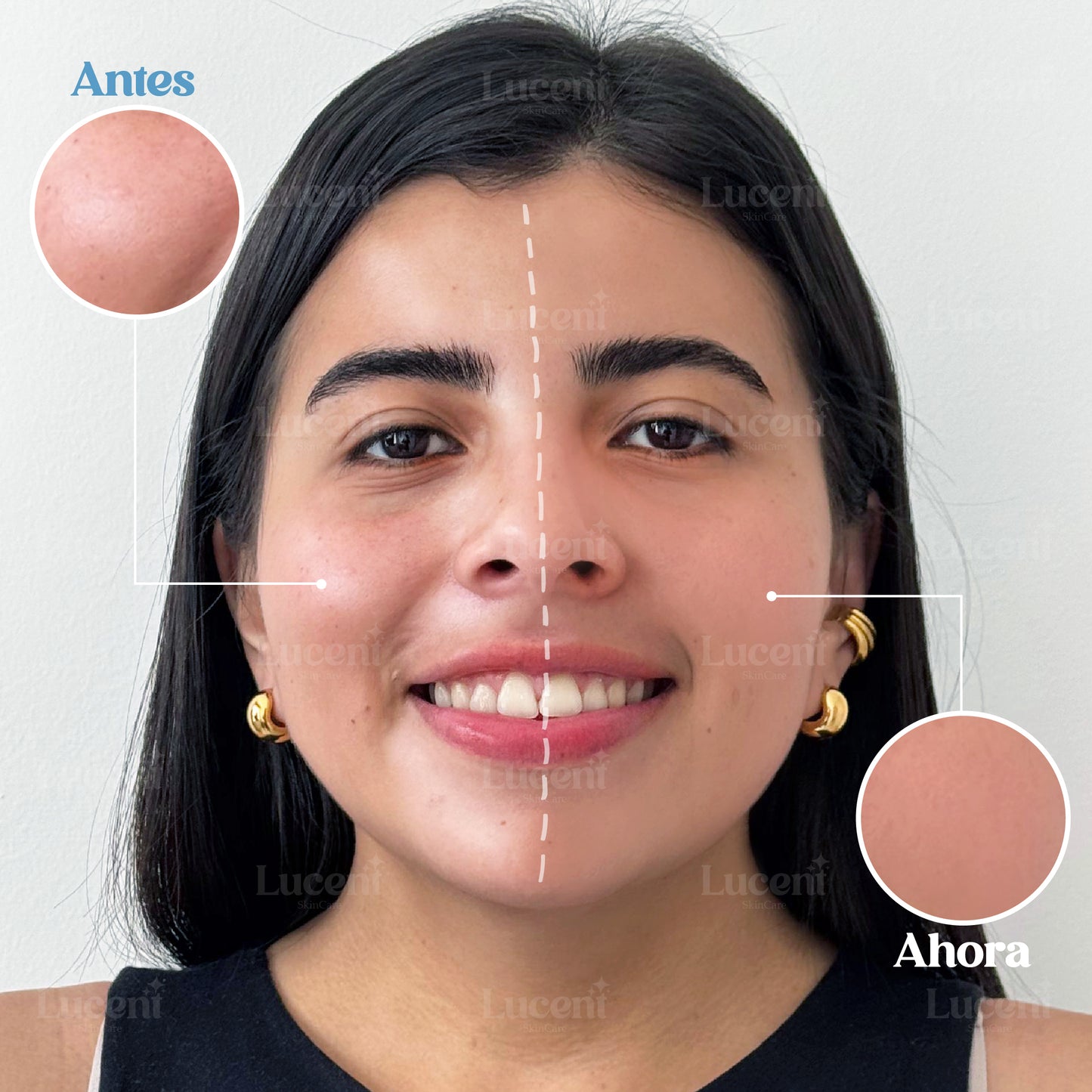 Candy Bella® | Gel prensado para control de grasa facial