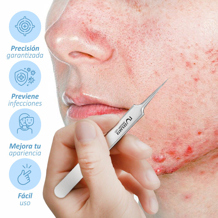 Espinillas Vanish 🌟 | Pinzas ultrafinas para espinillas * 8 Piezas