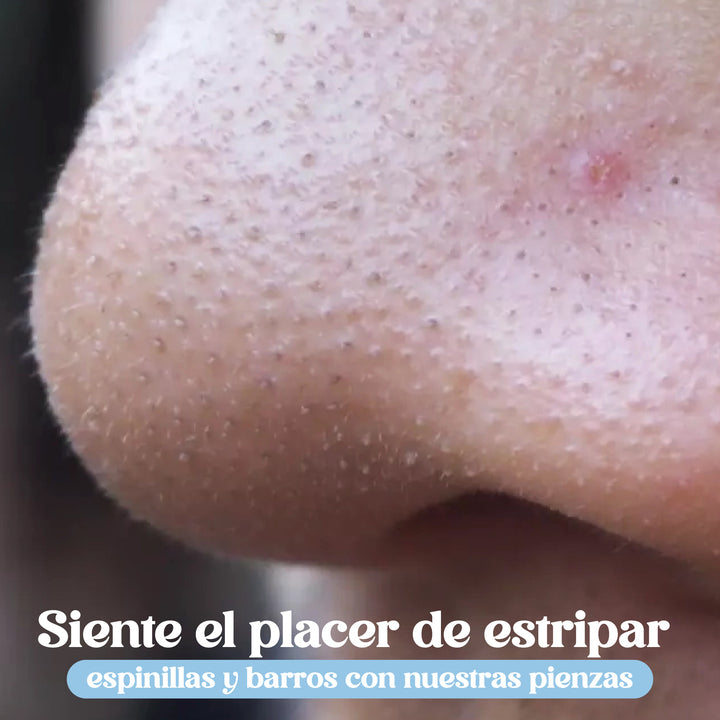 Espinillas Vanish 🌟 | Pinzas ultrafinas para espinillas * 8 Piezas