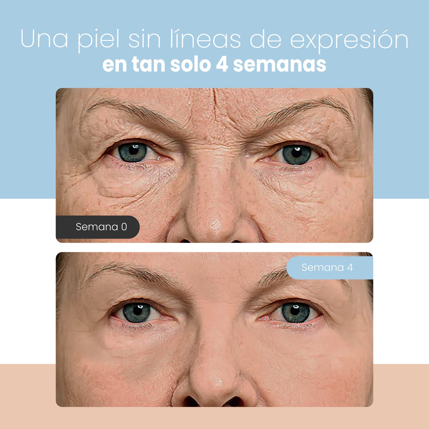 ScareRase°  | Cinta para eliminar líneas de expresión en pocas Semanas