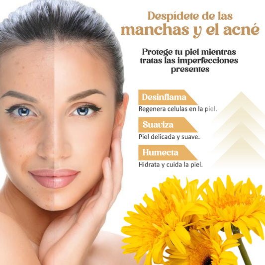 Jabón de cúrcuma  y Caléndula | tratamiento contra manchas y acné
