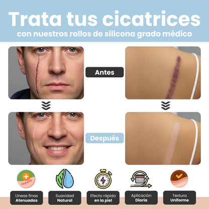 ScareRase°  | Cinta para eliminar líneas de expresión en pocas Semanas