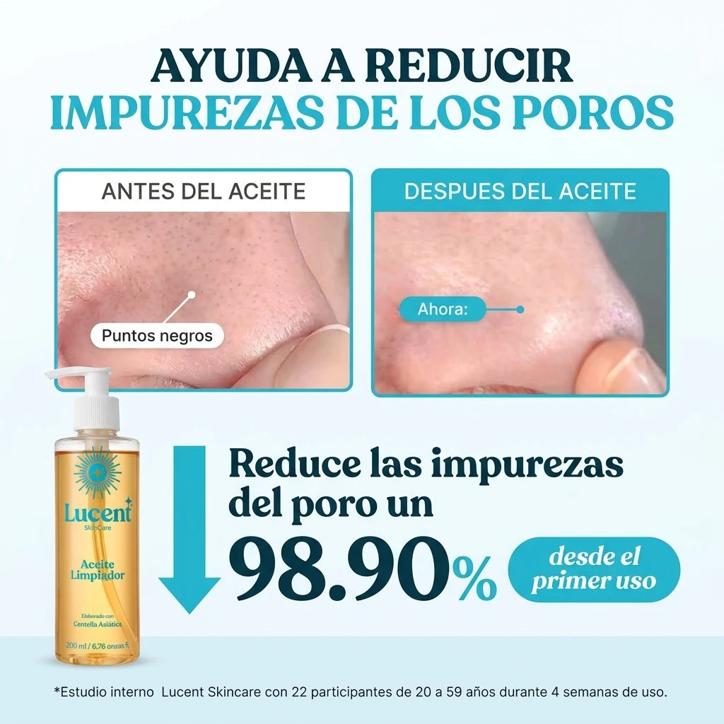 Aceite Limpiador de Centella Asiática Lucent | Control de Poros y Sebo para Piel Radiante